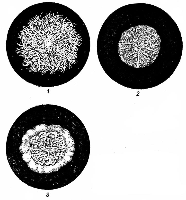 Развитие колоний. Колонии бацилл. . Колония бактерий картофельной палочки. Сенная палочка колонии. Колонии аэробных бактерий.